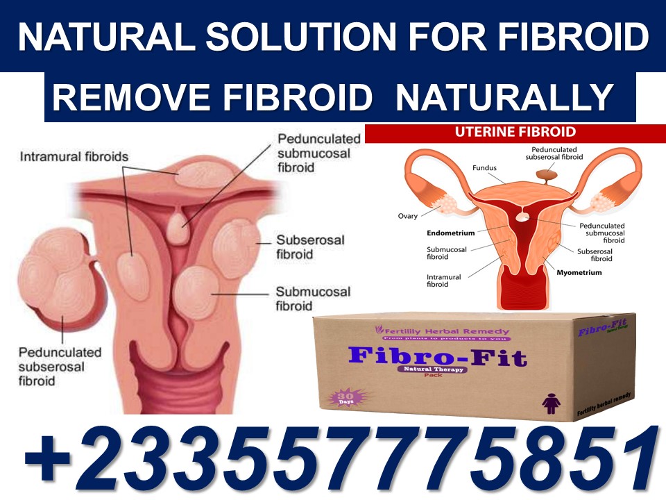 FIBROID TREATMENT IN GHANA