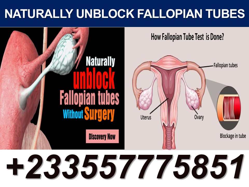 Remedy For Fallopian Tube Blockage