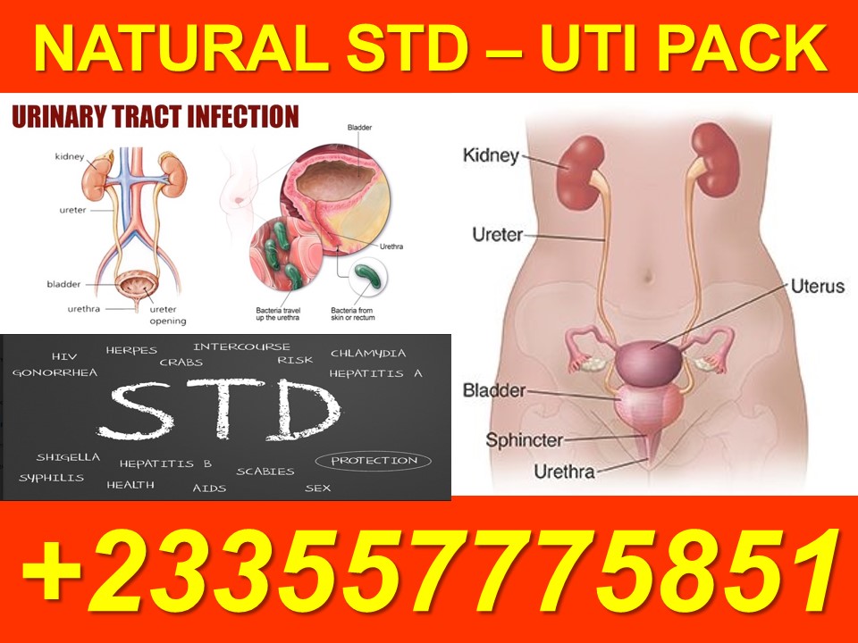 How to Treat Urinary Tract Infection
