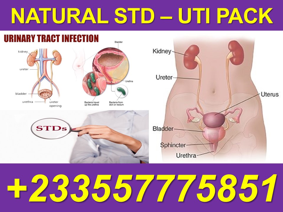 How To Treat UTI in Ghana