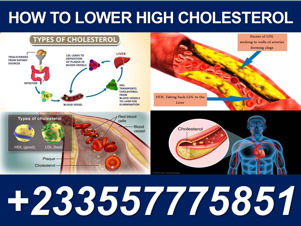 Natural Remedy For High Cholesterol