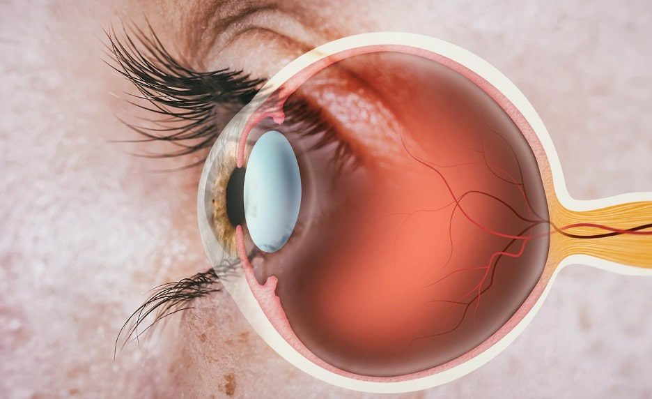 How To Improve Your Vision & Restore Your Eyesight