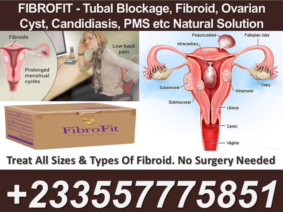 Holistic Fibroid Management in Ghana | Natural Solutions for Women's Health